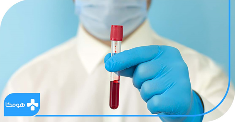 آزمایش چکاپ کامل